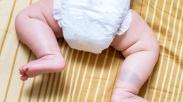 USG bioderek niemowlaka. Czym jest dysplazja stawów biodrowych?