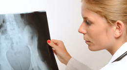 Nowotwór kości - najczęstsze objawy. Leczenie i rokowanie
