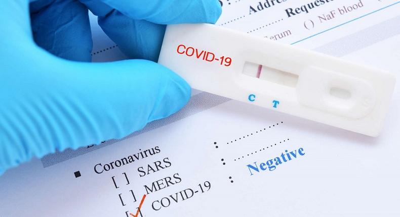 Test coronavirus negatif