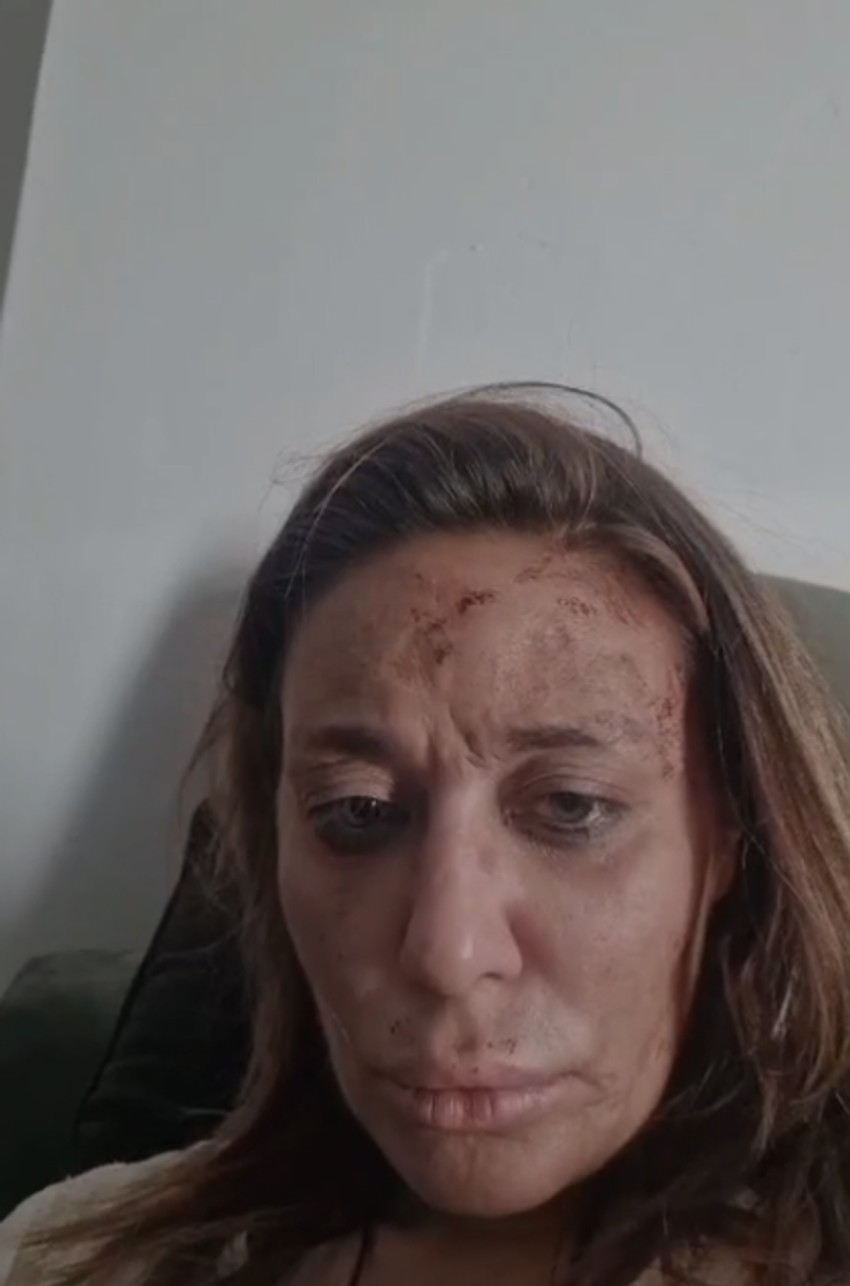 Pretučena Ana Nikolić