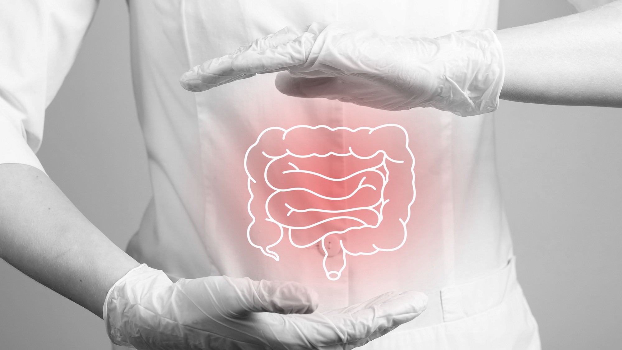 Rakovina hrubého čreva je jednou z najčastejších foriem rakoviny vo svete (ilustračné foto).