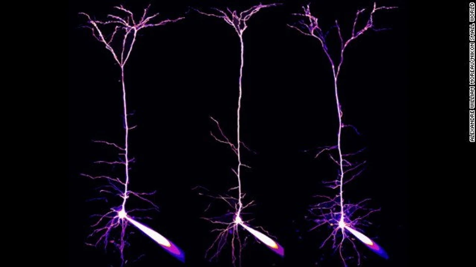 Alekander Vilijam Moro - piramidalni neuroni i njihovi dendriti u vidnom korteksu mišjeg mozga