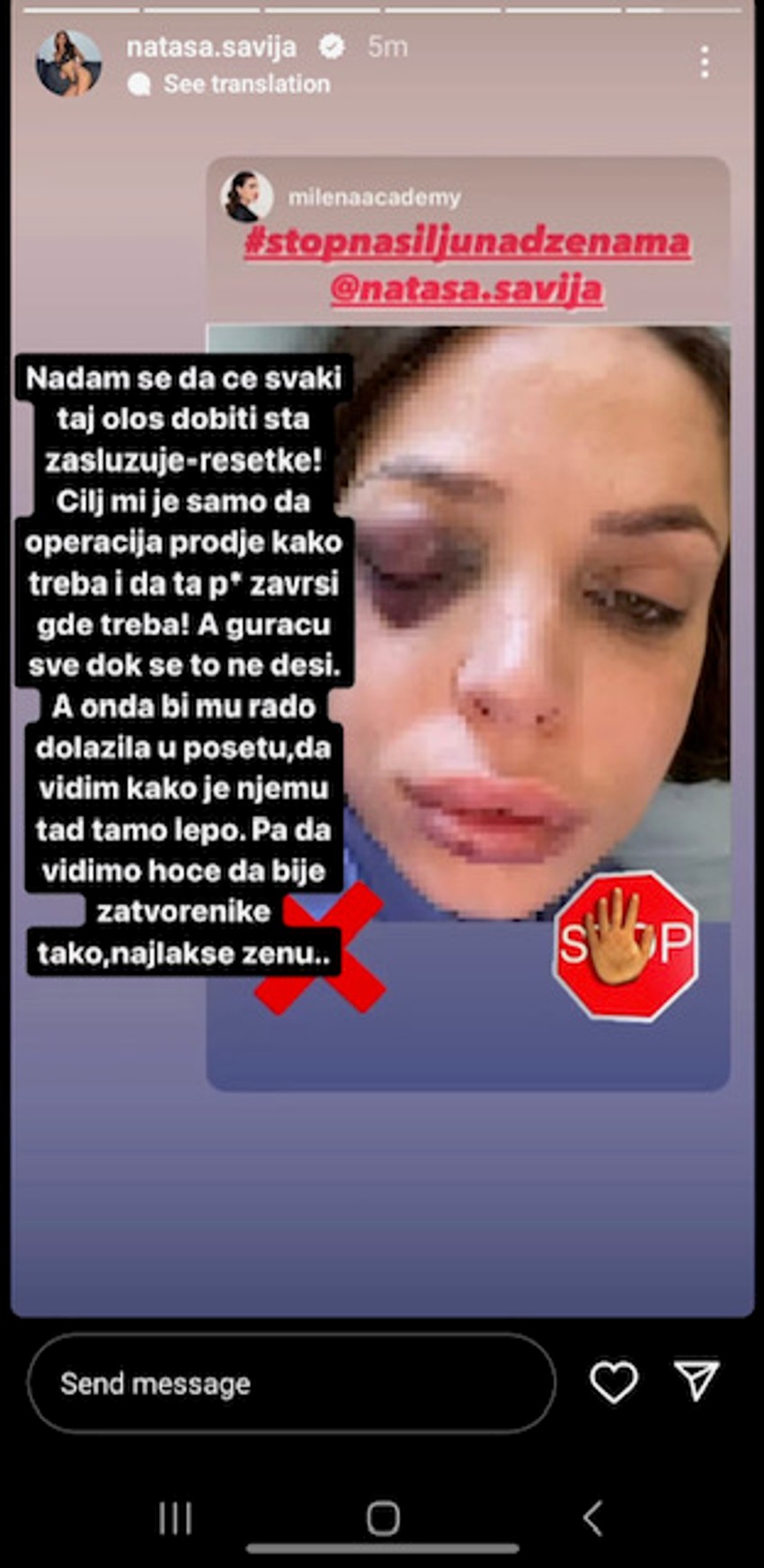 Oglasila se pretučena Šavija