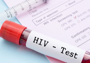 Testiranje na HIV je besplatno i poverljivo