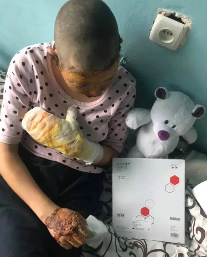 Ani će trebati plastična operacija lica