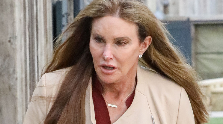 Caitlyn Jenner nózijának hegyét rejtélyes, vörös folt mászta meg /Fotó: Northfoto