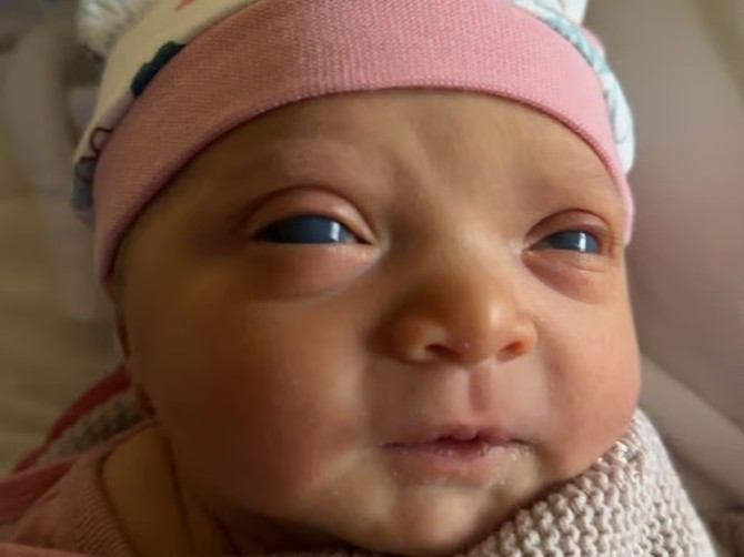 Moja ćerka je rođena sa najlepšom bojom očiju, a onda je dobila dijagnozu 'jedna u milion'