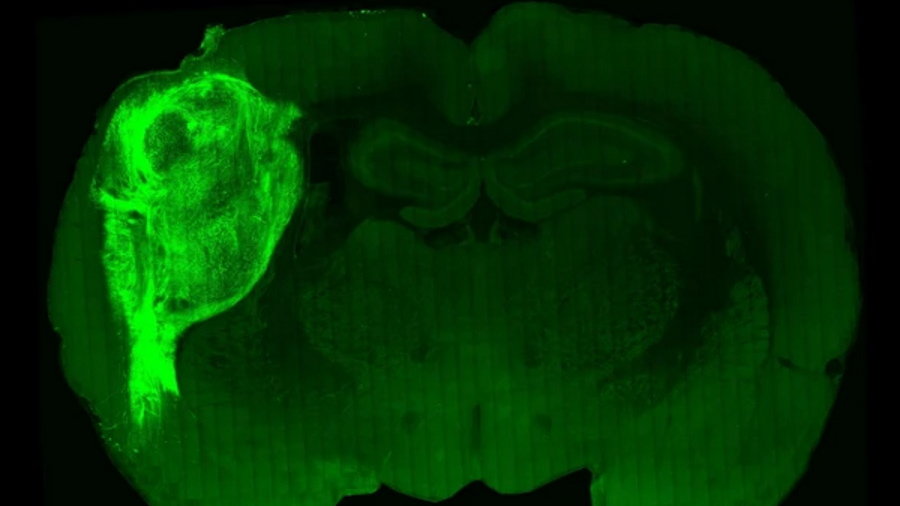 Miniaturowe ludzkie mózgi wszczepione szczurom, fot. Stanford University