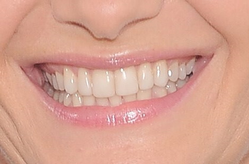 Zdrowe zęby Małgorzaty Kożuchowskiej