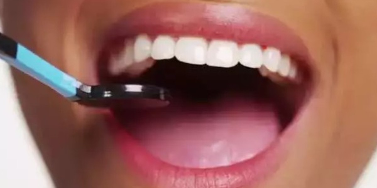 5 ways to naturally whiten your teeth at home - Vimarsana News