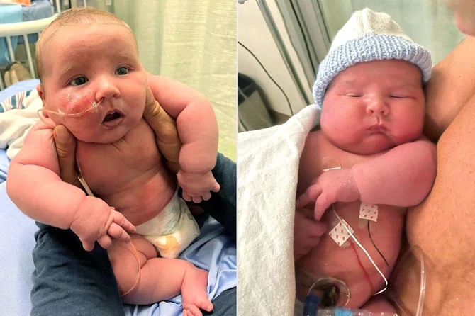 Grejson u porodilištu