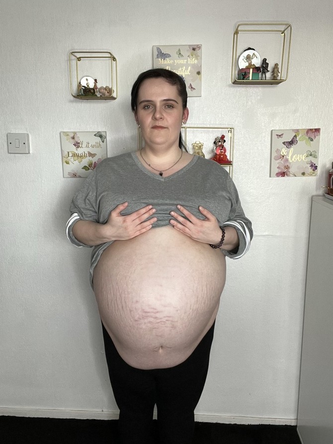 Mislili su da je trudna a onda je otišla na prgled i usledio je šok