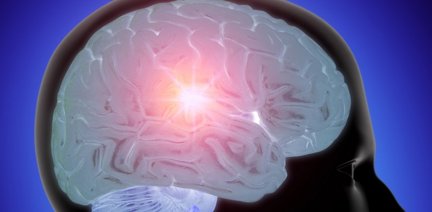 Epidemia Alzheimera spowoduje zagładę ludzkości?