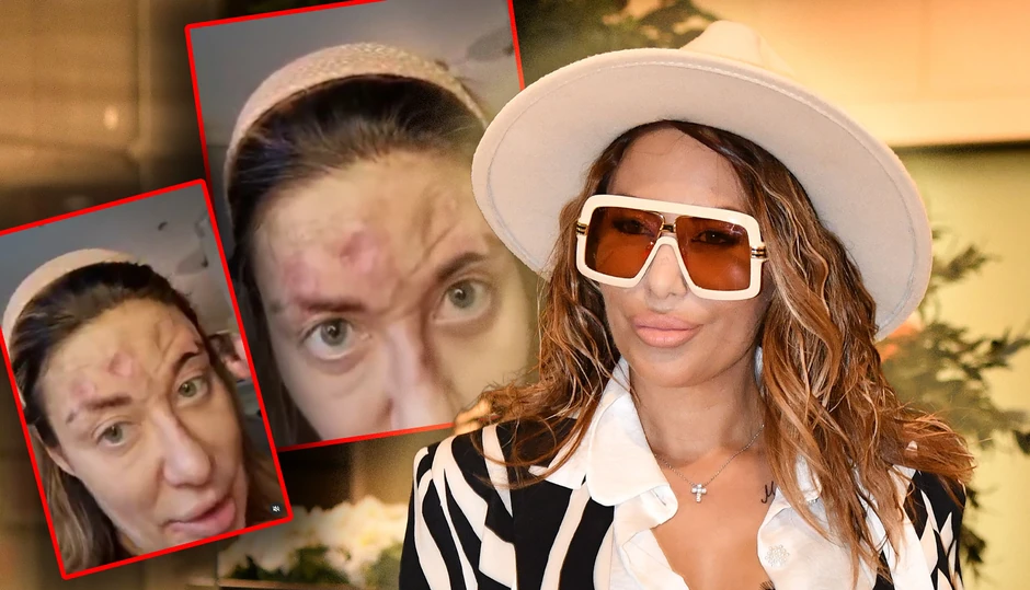 Ana Nikolić sa problemima na licu