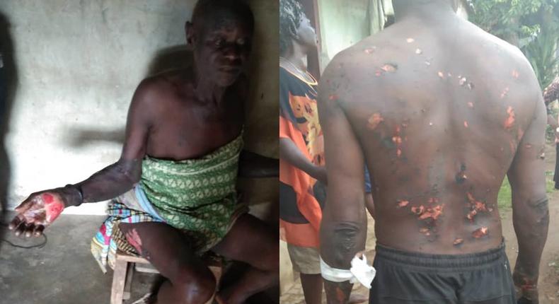 Nigerian governors Special Advisor burns locals because they fought him in his dream (photos)