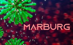 Kolejny wirus atakuje. 'Zabija niemal 90 proc. zakażonych'