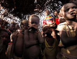 Somalia umiera. Nie tylko głód, ale też cholera