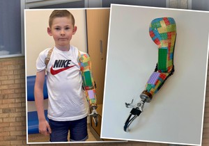 Tobi i njegova lego ruka 