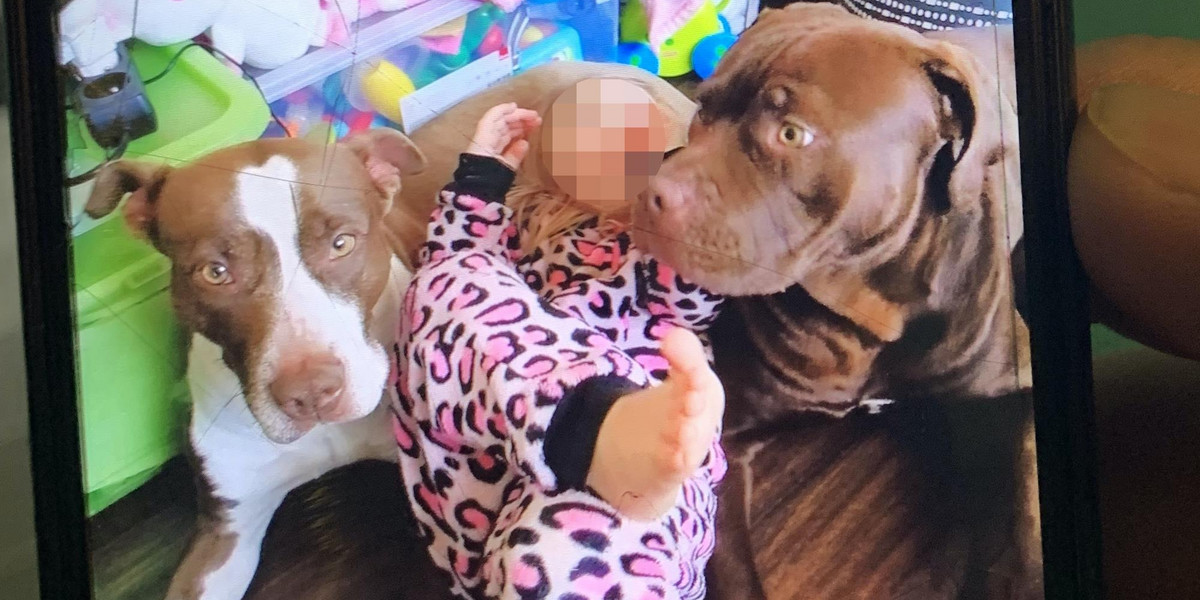 Na zdjęciu pitbull (po prawej), który zaatakował dziecko.