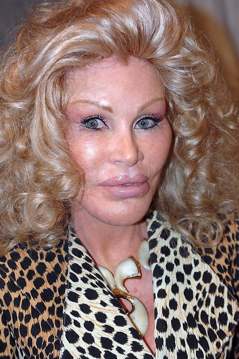 Jocelyn Wildenstein