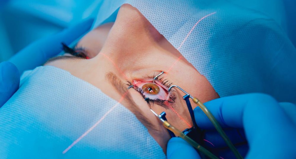 Przygotowanie do laserowej korekcji wzroku. O czym pamietac?