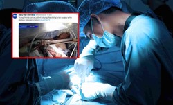 Grał na gitarze podczas swojej operacji. "Nie mogłem tego przegapić"