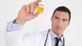 Badania moczu pracownika: kiedy są obowiązkowe i kto musi je wykonać?