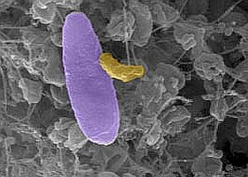 vampir-bakterium-d000011C338dab5301de9