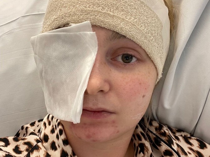 Otišla je na rutinski pregled kod oftamologa, a u glavi je nosila džinovski tumor