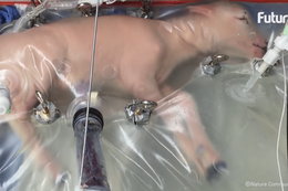 Naukowcy stworzyli sztuczną macicę. Ma pomóc w rozwoju wcześniaków