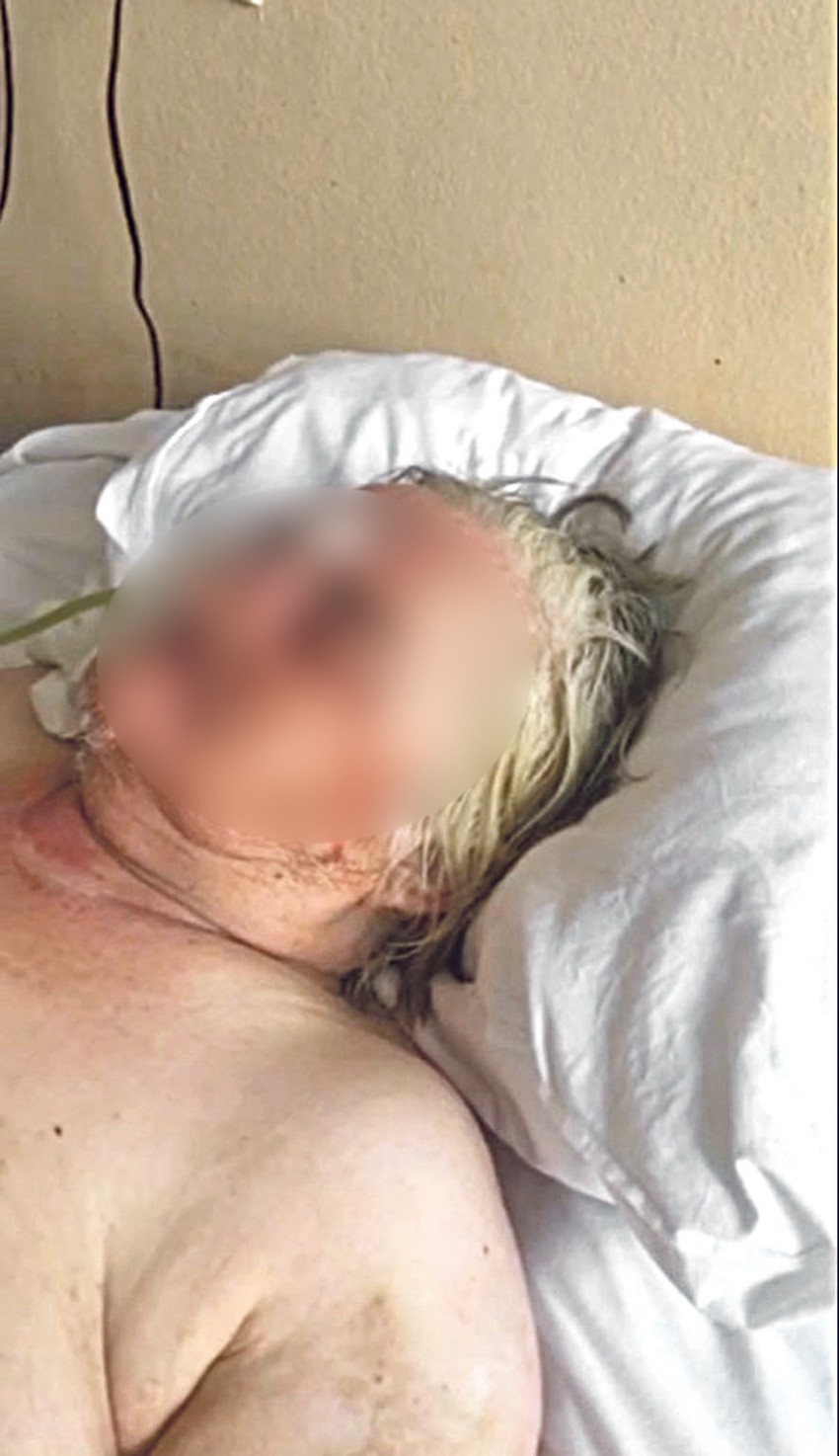 Starica je pretučena u bolničkoj postelji