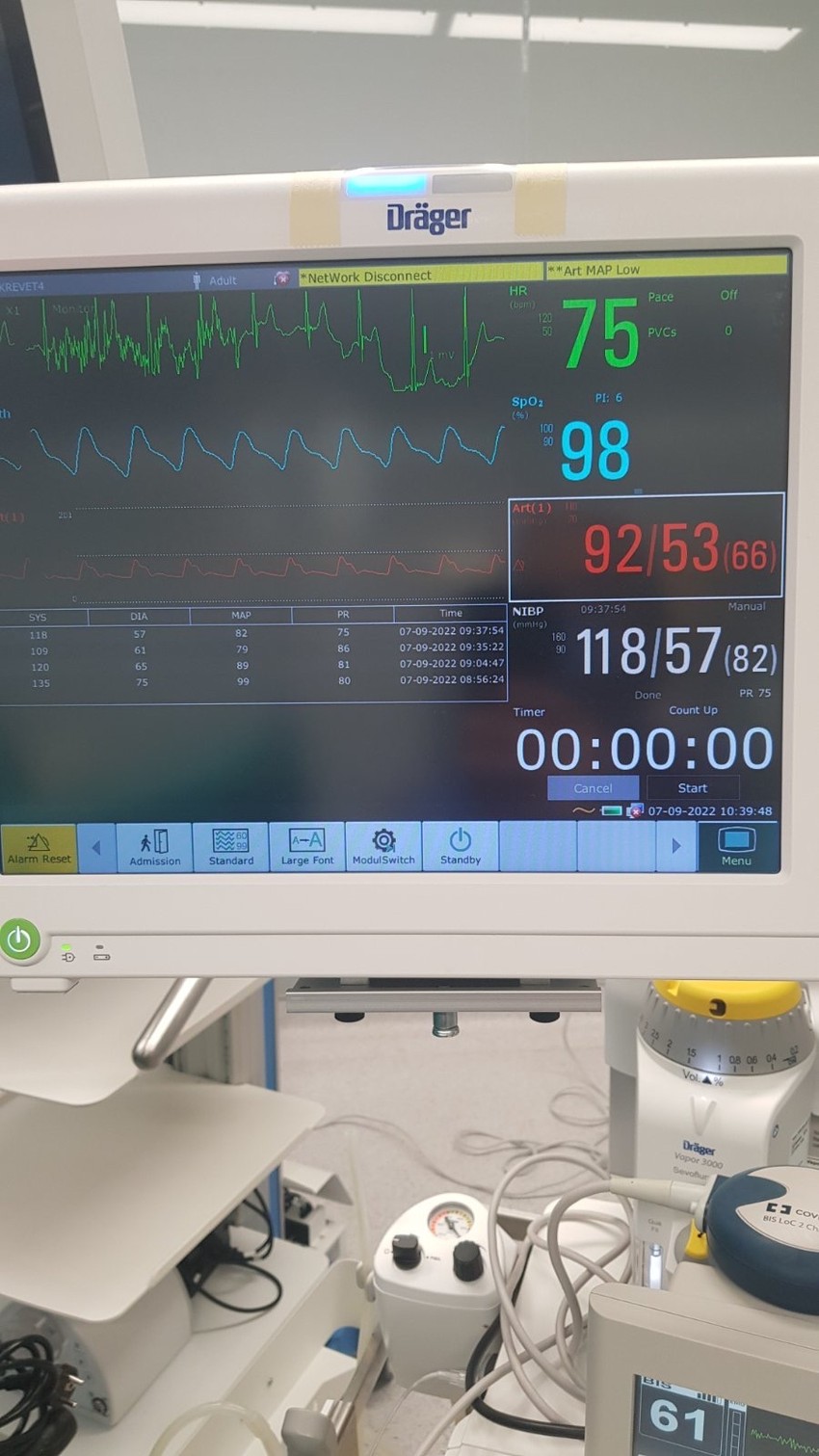 Praćenje parametara