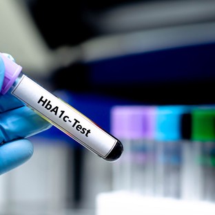 HbA1c, a cukorbetegek időgépe: miért kell ellenőrizni, és miért nehéz néha beállítani?