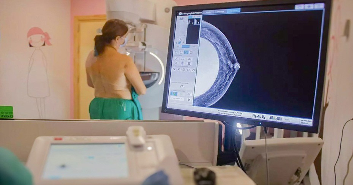 Andalucía completa el 90% de las mamografías pendientes a 2.317 mujeres