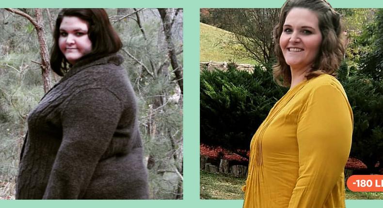'I've Kept Off 183 Lbs. Since Bariatric Surgery'