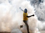 Why you shouldn't wash your face immediately after exposure to teargas