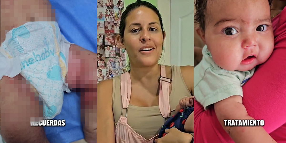 Szokujące nagranie skóry niemowlęcia. Pediatra ostrzega: "Nie popełniajcie tego błędu!"