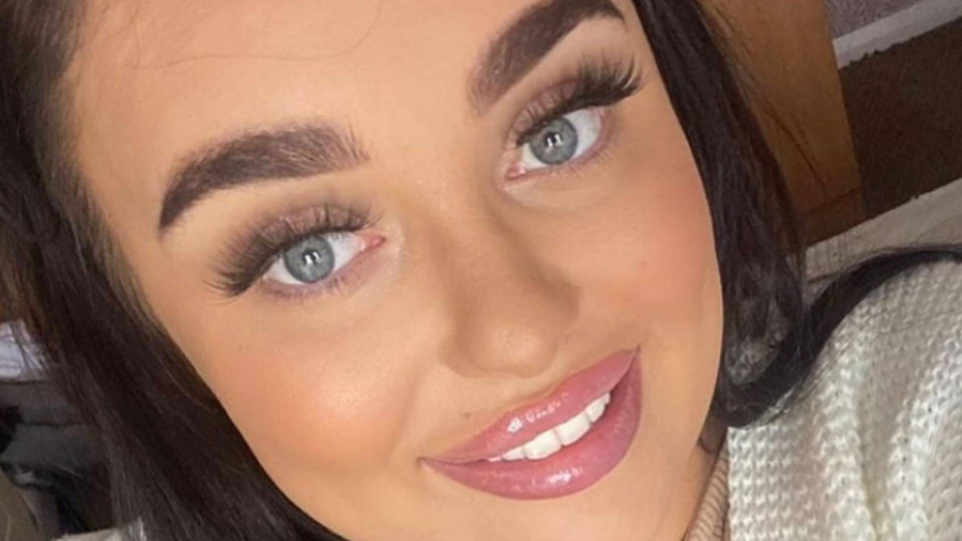 A 21 éves lány majdnem megvakult, miután rosszul adták be neki a szájfeltöltő injekciót  - fotók