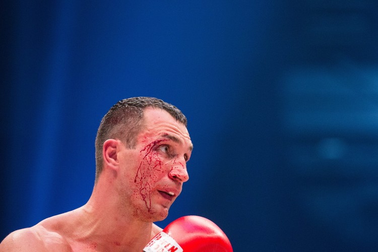 Tak Fury 'wlał' Kliczce i zabrał mu mistrzowskie pasy