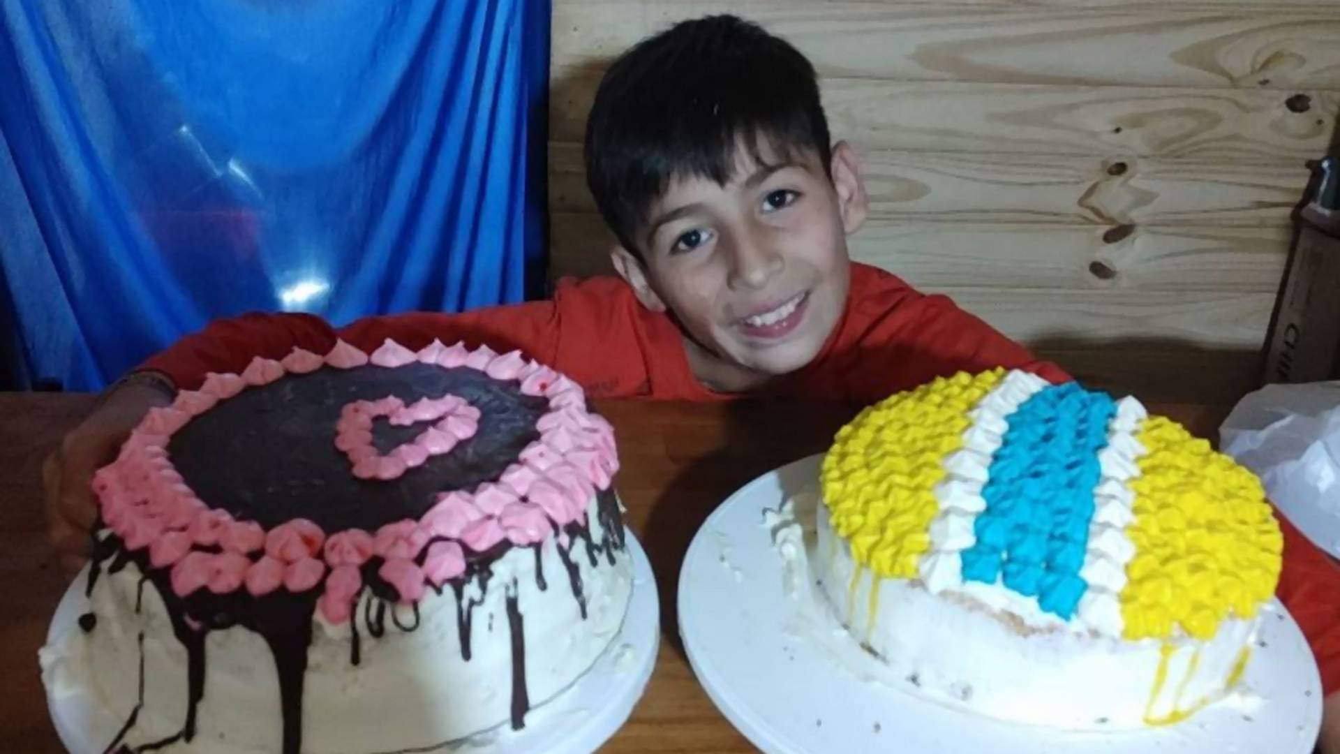 Desetogodišnji dečak pravi i prodaje kolače kako bi sakupio novac za operaciju lica koje mu je izgorelo