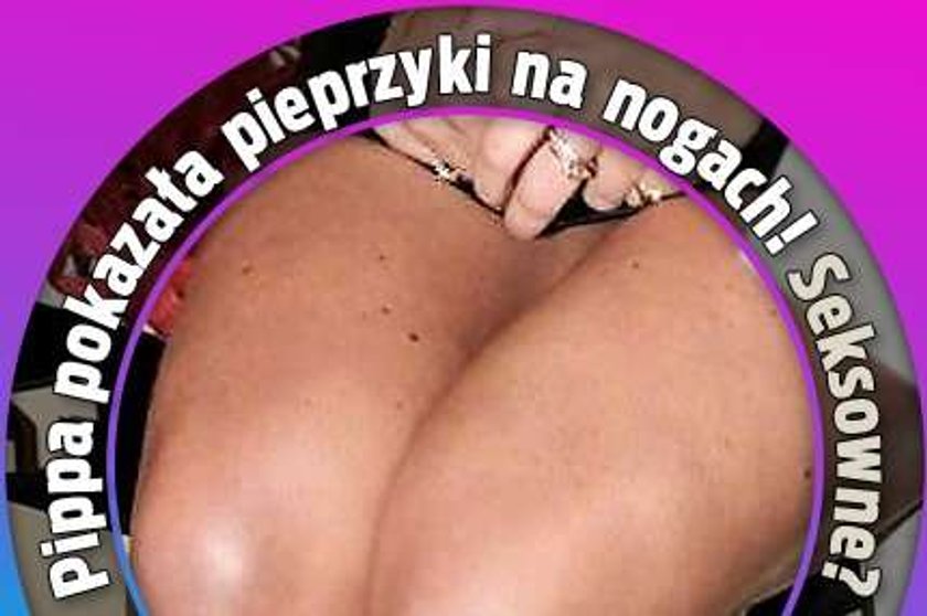 Pippa pokazała pieprzyki na nogach! Seksowne?