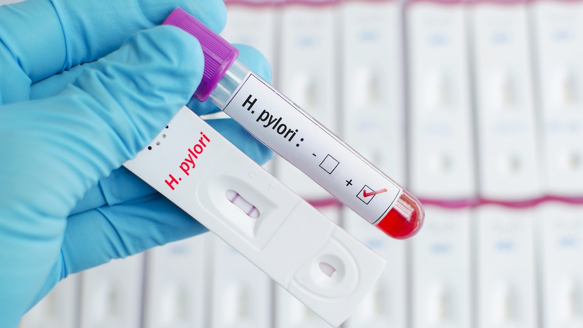 Test krvi na helikobakteriju nije najpouzdaniji