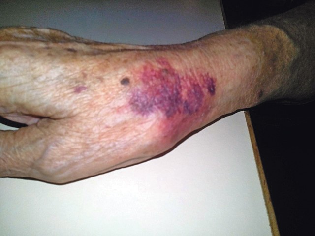 Ćerka prvo nije mogla da veruje da joj je majka pretučena, a onda je to potvrdila i cimerka iz sobe u domu