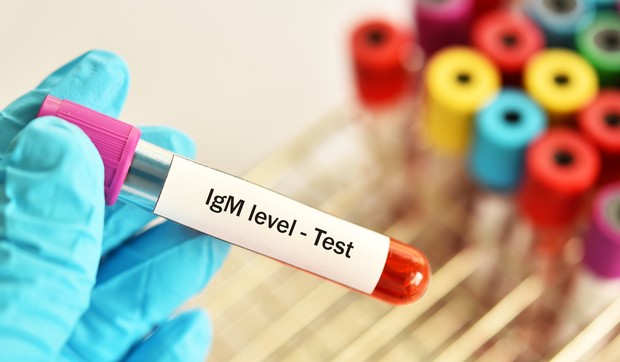  IgM antitela