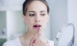 Zimno na ustach ─ objawy, przyczyny i leczenie