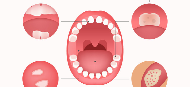 Jak dbać o higienę jamy ustnej od niemowlęcia do dziecka? [INFOGRAFIKA] [INFOGRAFIKA]