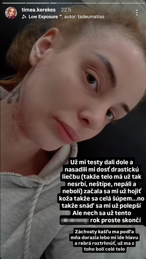 Timea Kerekeš bojuje s nepríjemnými zdravotnými problémami.