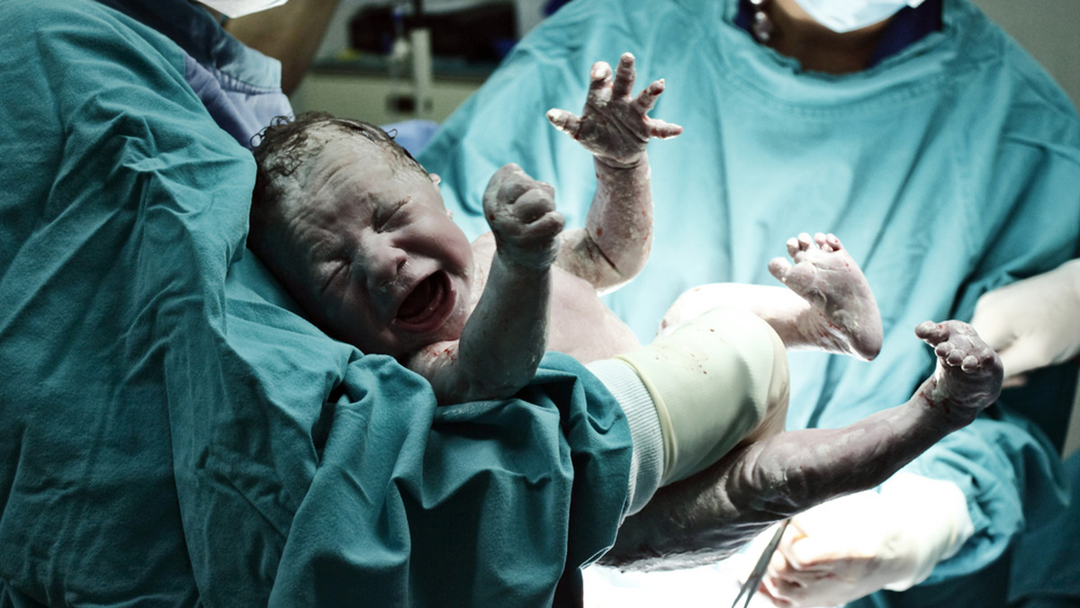 Obrzęknięte i zaczerwienione powieki, skóra pokryta mazią płodową (tłustą białą wydzieliną) - tak prezentuje się noworodek zaraz po porodzie.