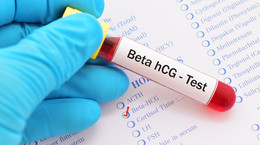 Badanie beta HCG w ciąży