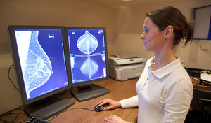 Zaawansowany rak piersi – co warto wiedzieć?